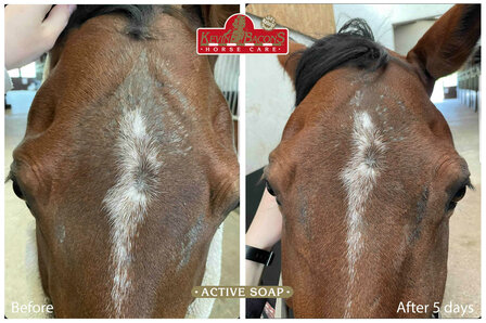 Kevin Bacon's Anti-jeuk zeep 100 gram