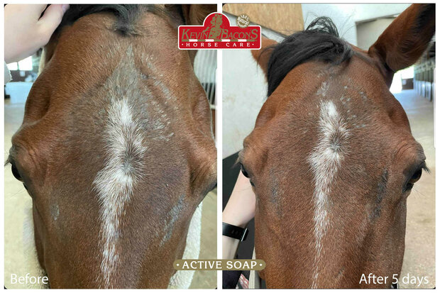 Kevin Bacon's Anti-jeuk zeep 100 gram